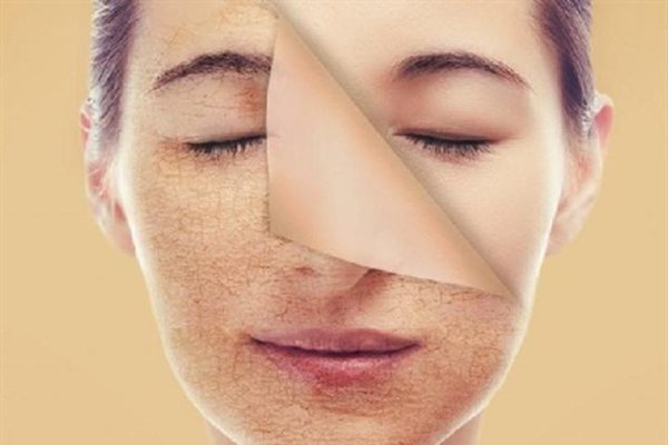 tẩy tế bào chết